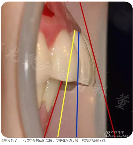 QQ圖片20150821095331.png QQ圖片20150821095331.png