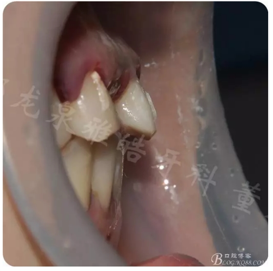 QQ圖片20150821095401.png QQ圖片20150821095401.png