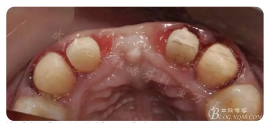 QQ圖片20150821095414.png QQ圖片20150821095414.png