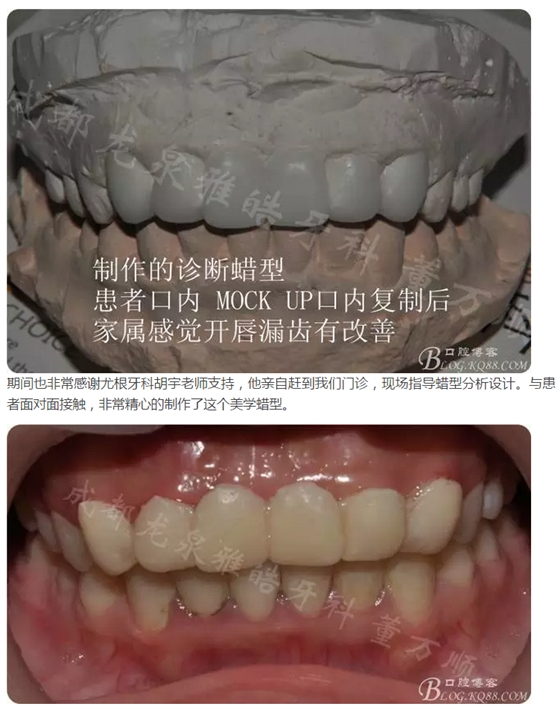 QQ圖片20150821095721.png QQ圖片20150821095721.png