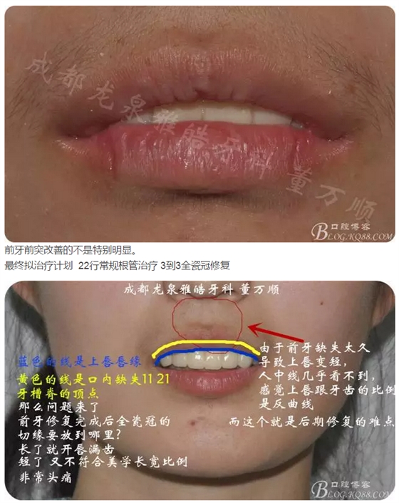 QQ圖片20150821095803.png QQ圖片20150821095803.png