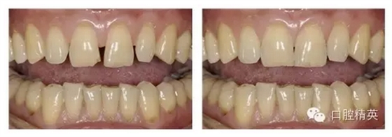 QQ圖片20150822144130.png QQ圖片20150822144130.png