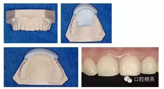 QQ圖片20150822144143.png QQ圖片20150822144143.png