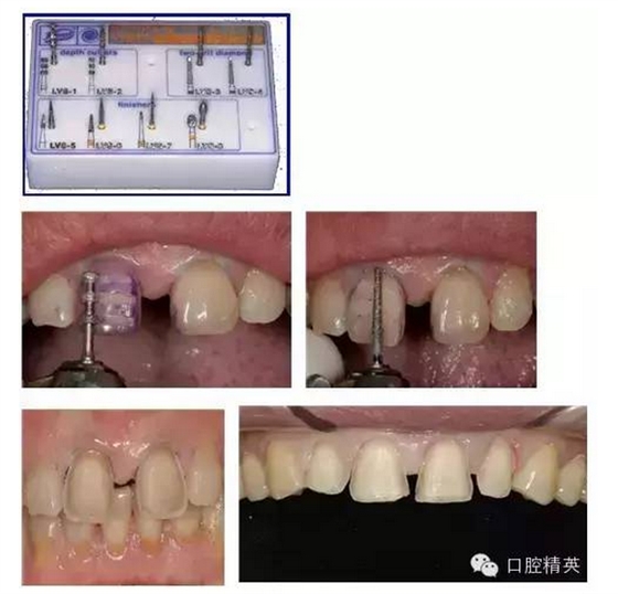 QQ圖片20150822144158.png QQ圖片20150822144158.png