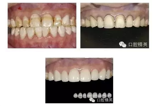 QQ圖片20150824101941.png QQ圖片20150824101941.png