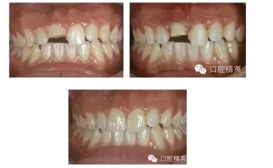 QQ圖片20150824101953.png QQ圖片20150824101953.png