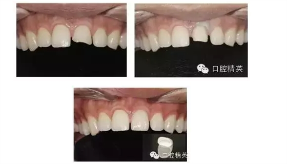 QQ圖片20150824102016.png QQ圖片20150824102016.png