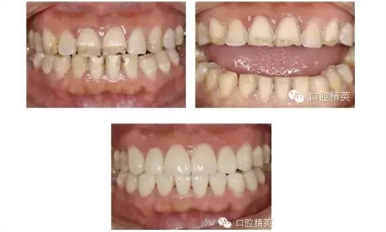 QQ圖片20150824102029.png QQ圖片20150824102029.png