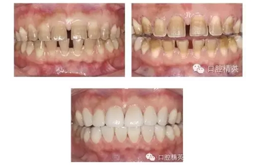 QQ圖片20150824102105.png QQ圖片20150824102105.png