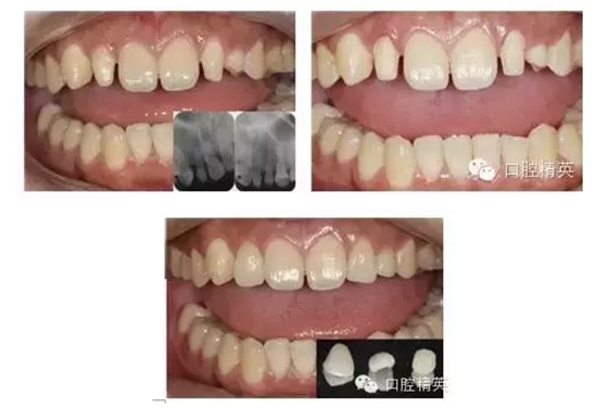 QQ圖片20150824102116.png QQ圖片20150824102116.png