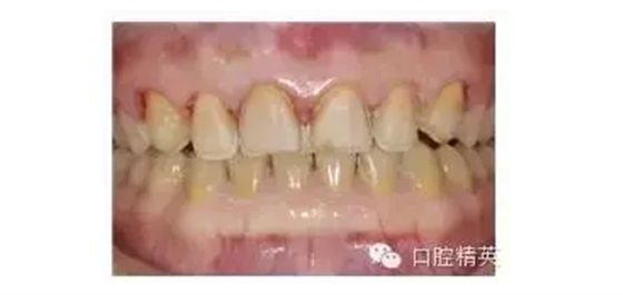 QQ圖片20150824102138.png QQ圖片20150824102138.png