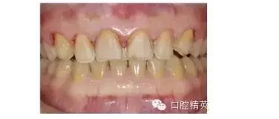 QQ圖片20150824102149.png QQ圖片20150824102149.png