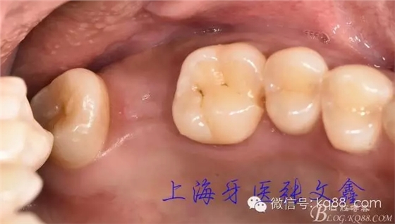 640 (1).webp (2).jpg 640 (1).webp (2).jpg