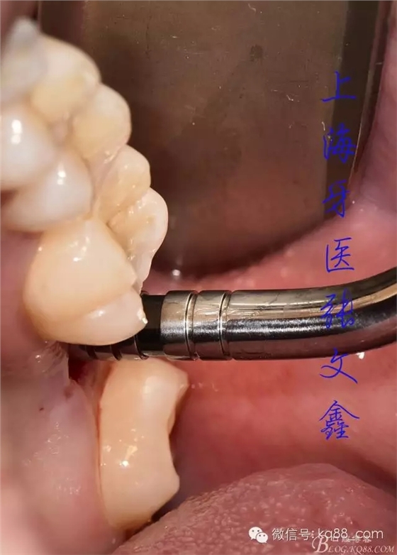 1111.webp.jpg 1111.webp.jpg