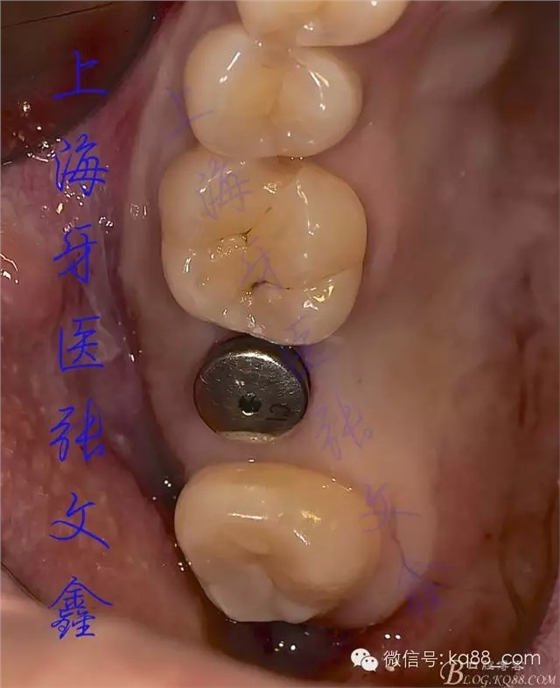 1113.webp.jpg 1113.webp.jpg