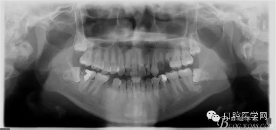 80.webp.jpg 80.webp.jpg