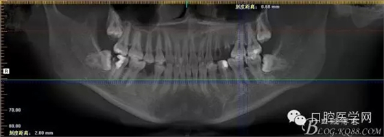 81.webp.jpg 81.webp.jpg