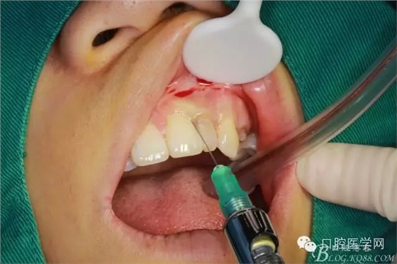 87.webp.jpg 87.webp.jpg