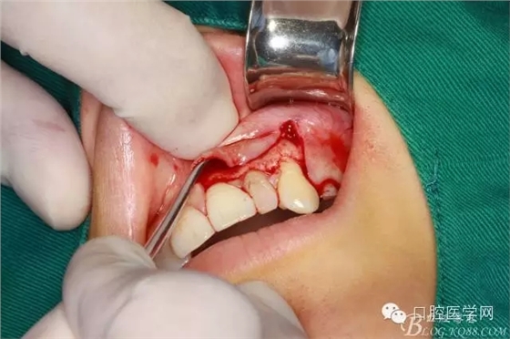 92.webp.jpg 92.webp.jpg