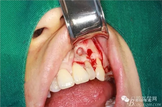 101.webp.jpg 101.webp.jpg