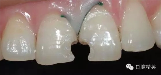 4.webp.jpg 4.webp.jpg