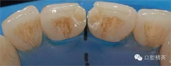 6.webp.jpg 6.webp.jpg