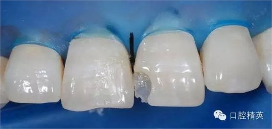 11.webp.jpg 11.webp.jpg