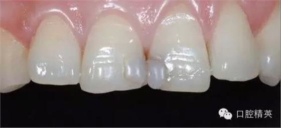 20.webp.jpg 20.webp.jpg