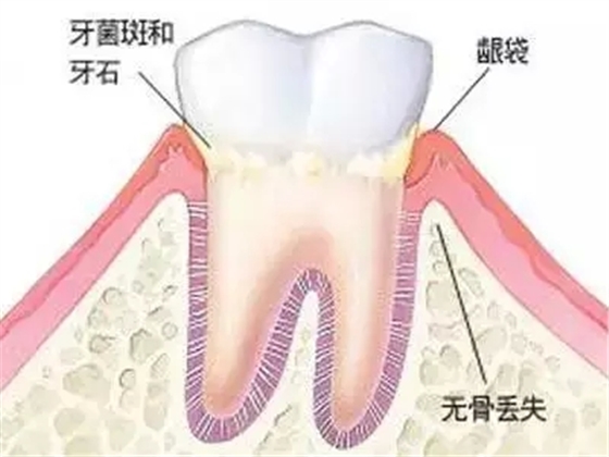 40.webp.jpg 40.webp.jpg