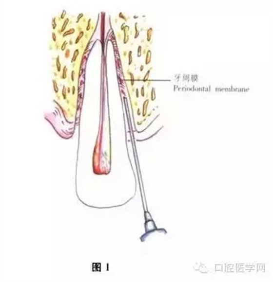 1.webp.jpg 1.webp.jpg