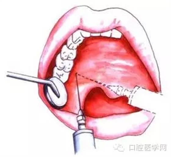 9.webp.jpg 9.webp.jpg