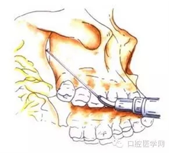 11.webp.jpg 11.webp.jpg