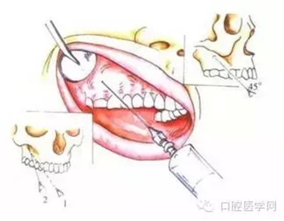 12.webp.jpg 12.webp.jpg