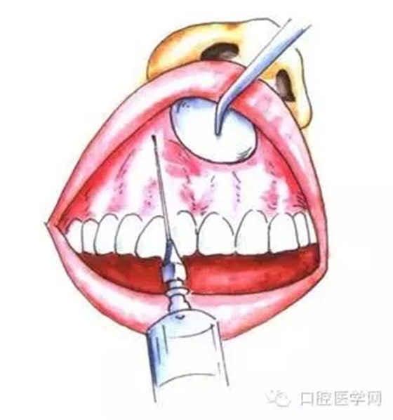 16.webp.jpg 16.webp.jpg