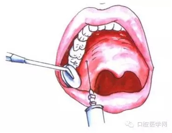 18.webp.jpg 18.webp.jpg