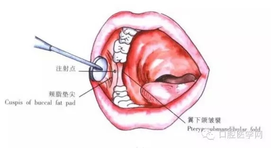 22.webp.jpg 22.webp.jpg