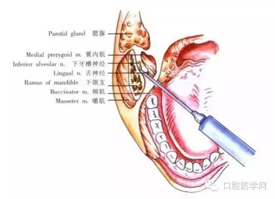 23.webp.jpg 23.webp.jpg