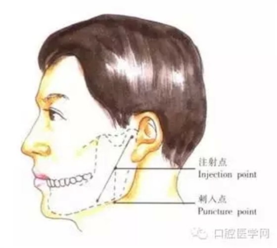 24.webp.jpg 24.webp.jpg