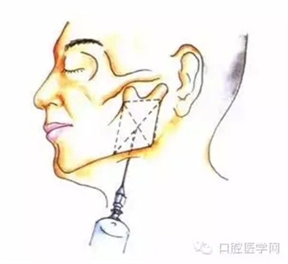 25.webp.jpg 25.webp.jpg