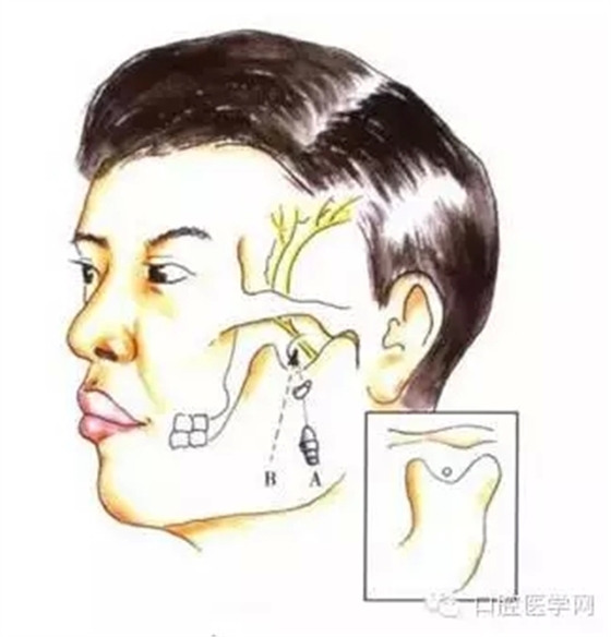 26.webp.jpg 26.webp.jpg