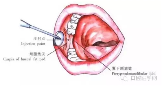 27.webp.jpg 27.webp.jpg