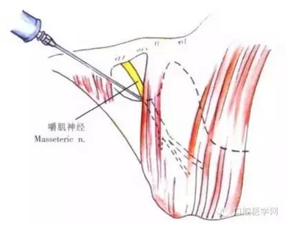 28.webp.jpg 28.webp.jpg