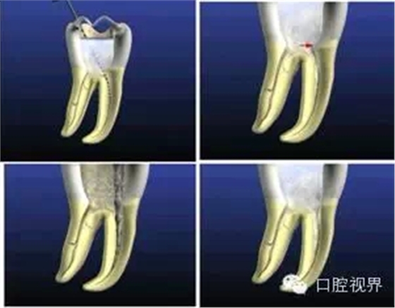 2.webp.jpg 2.webp.jpg