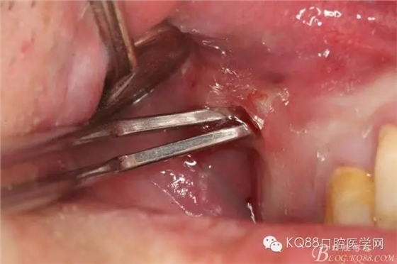 10.webp.jpg 10.webp.jpg