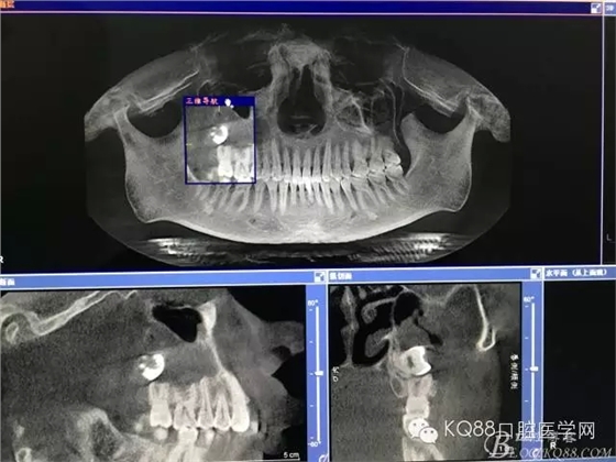 13.webp.jpg 13.webp.jpg