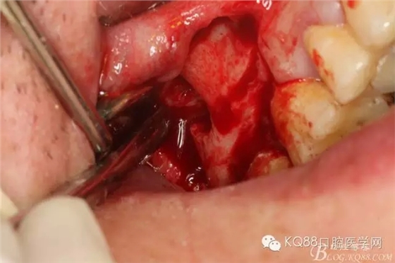 18.webp.jpg 18.webp.jpg