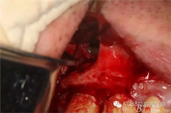 20.webp.jpg 20.webp.jpg