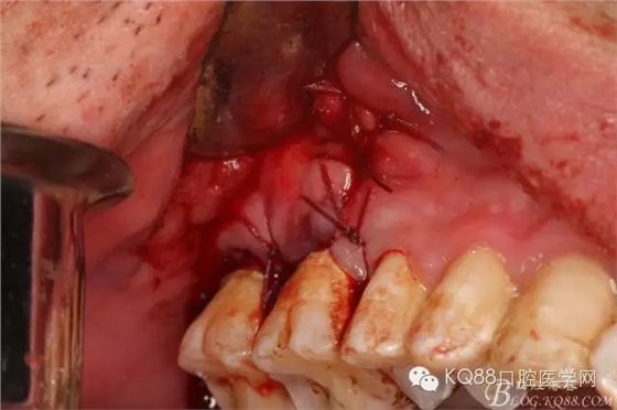 27.webp.jpg 27.webp.jpg