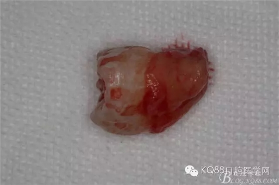 28.webp.jpg 28.webp.jpg