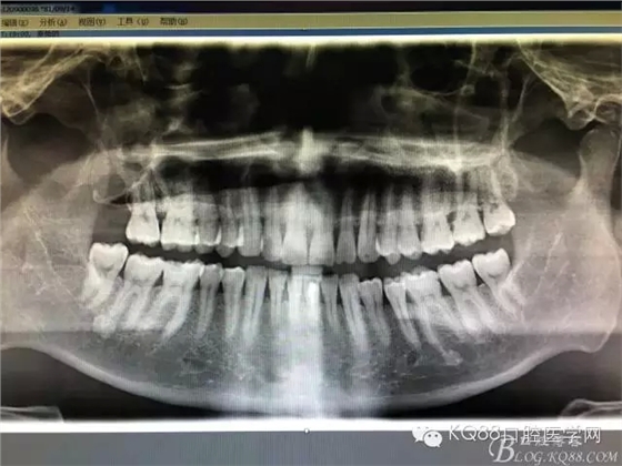 29.webp.jpg 29.webp.jpg